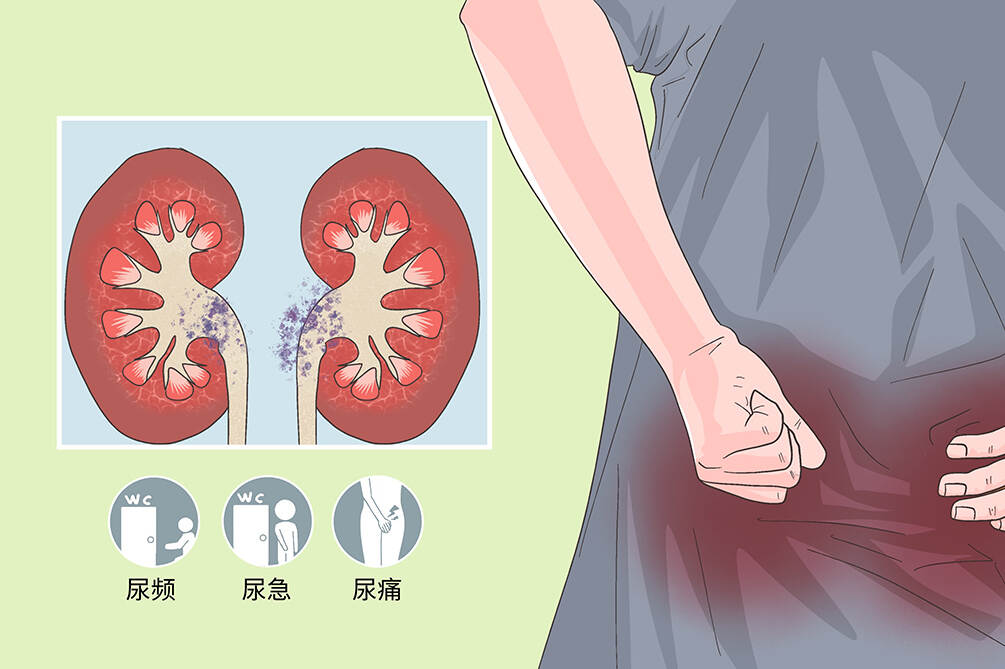 肾盂肾炎蛋白尿、咱们这里有绝招！专治慢性肾盂性肾炎【也就是尿蛋白尿】的，这是我妈亲自吃过的非常有用