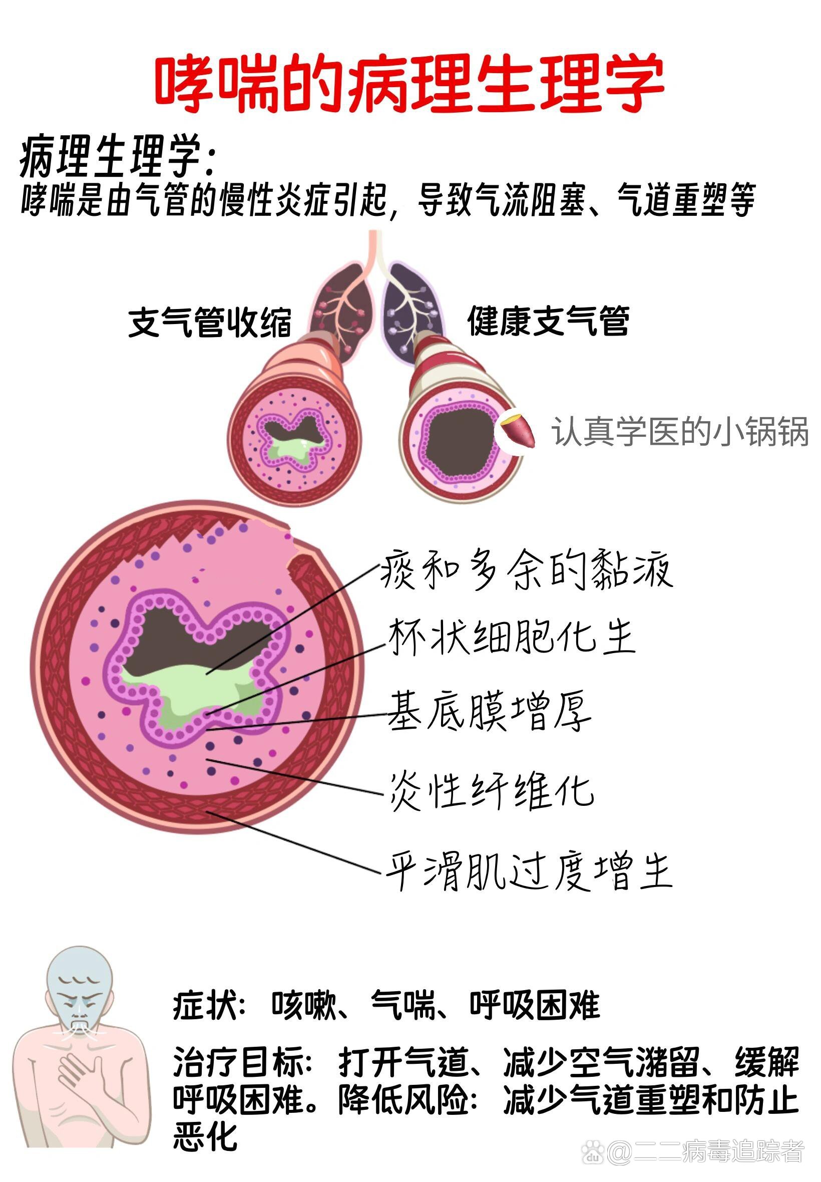 哮喘的方子，食疗方子治好它！哮喘的方子，是我前几天经过老年大学门口，几个老人聊天时我得来的，希望对患者有用。