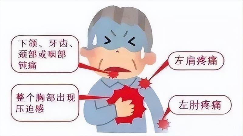 心绞痛