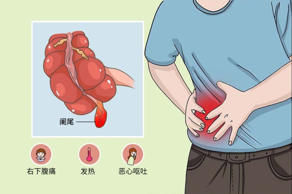 慢性阑尾炎：症状：右侧小腹部疼痛，腹胀恶心、有嗳气，大便不畅或者干燥。