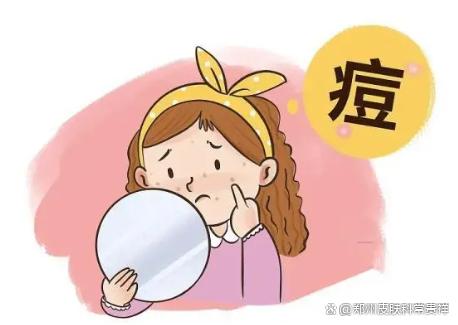 青春痘二方子内服，加外用的